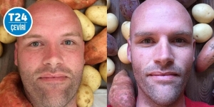 Bir yıl boyunca sadece patates yiyen adam 50 kilo verdi
