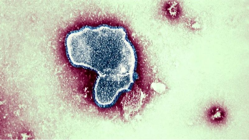 RSV virüsü: Teneffüs yolu hastalıklarına yol açan virüs son devirde çocuklarda neden daha fazla görülüyor?