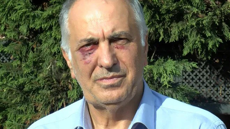 Kartal Cemevi Başkanı Selami Sarıtaş uğradığı saldırıyı anlattı: Kaosa fırsat vermeden bu günleri atlatacağız