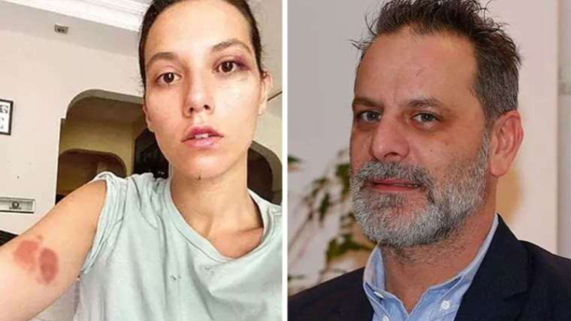 Ozan Güven günler sonra görüntülendi: Evden çıkmıyorum