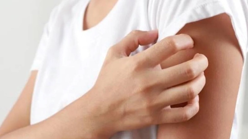 "Dermatoloji hastalarının yüzde 20'sini uyuz vakaları oluşturuyor"