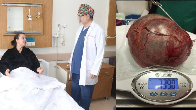 Een ziekenhuisbezoek resulteert in het verwijderen van een buikmassa van 7 kilogram om af te vallen