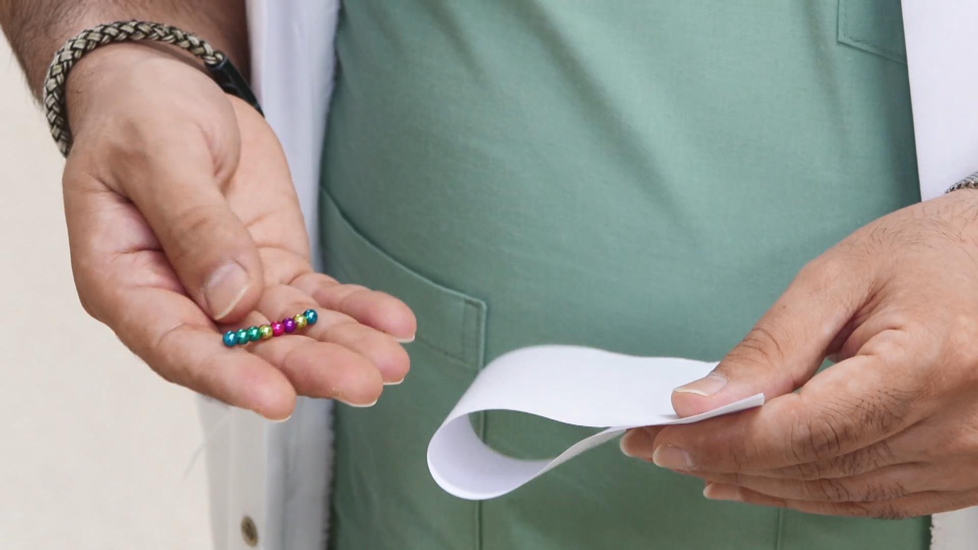 Doktorları bile şoke eden vaka: 3 yaşındaki çocuğun karnında 66 adet mıknatıs çıkarıldı!