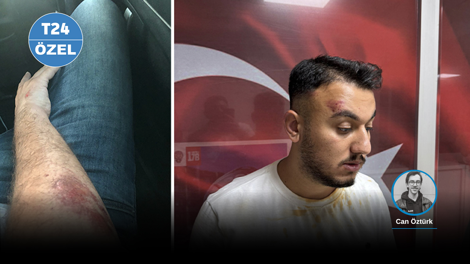 can darp can psd