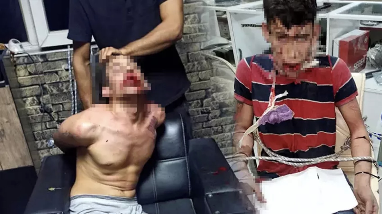 Böcek yedirip, dişlerini kırdılar: İstenen ceza belli oldu