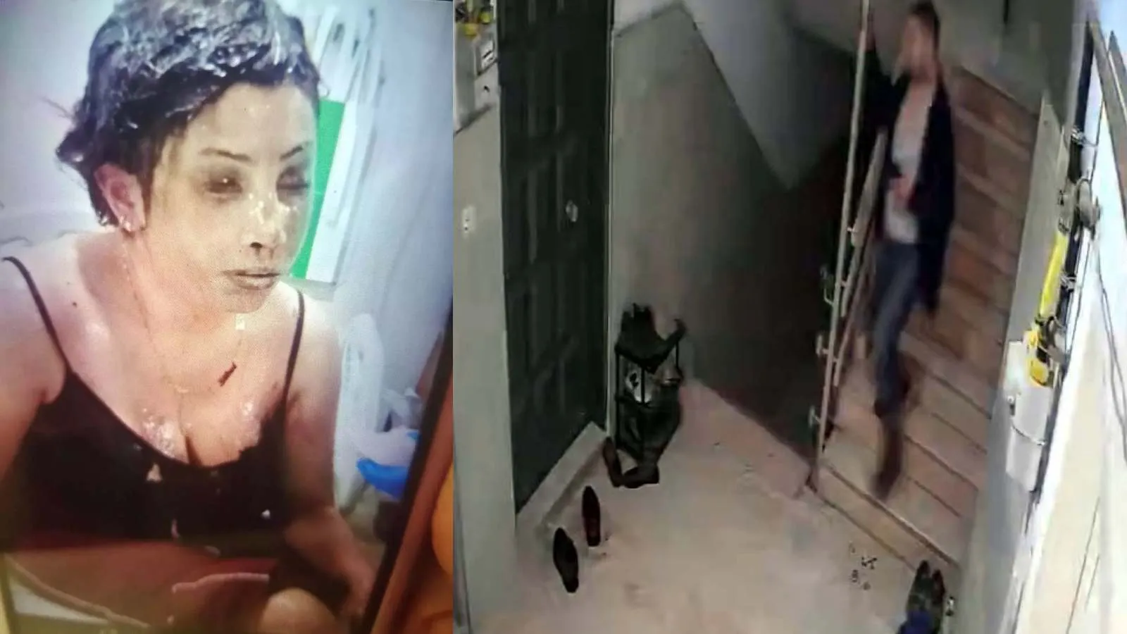 Kadına şiddet son bulmuyor: Boşanma aşamasındaki eşini koli bandı ile bağlayıp, başından aşağı kezzap döktü!