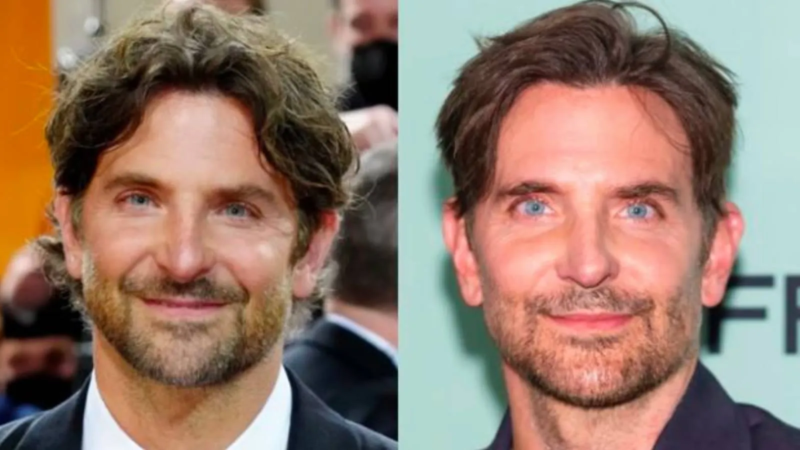 Bradley Cooper'dan estetik yaptırdığı iddialarına yanıt