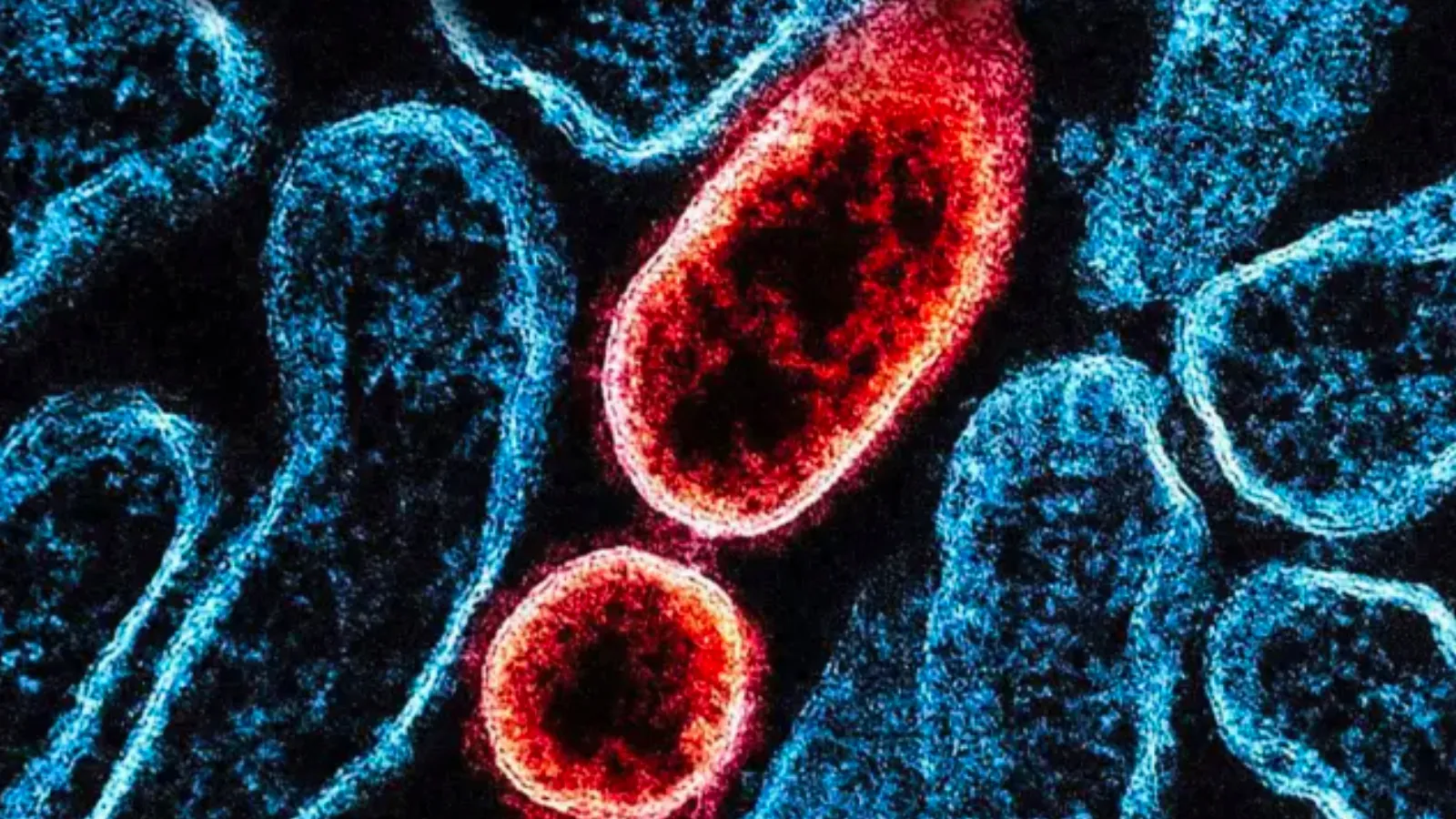 Yarasalardan bulaşan 27 yıllık virüs: Yeni salgın kapıda mı?