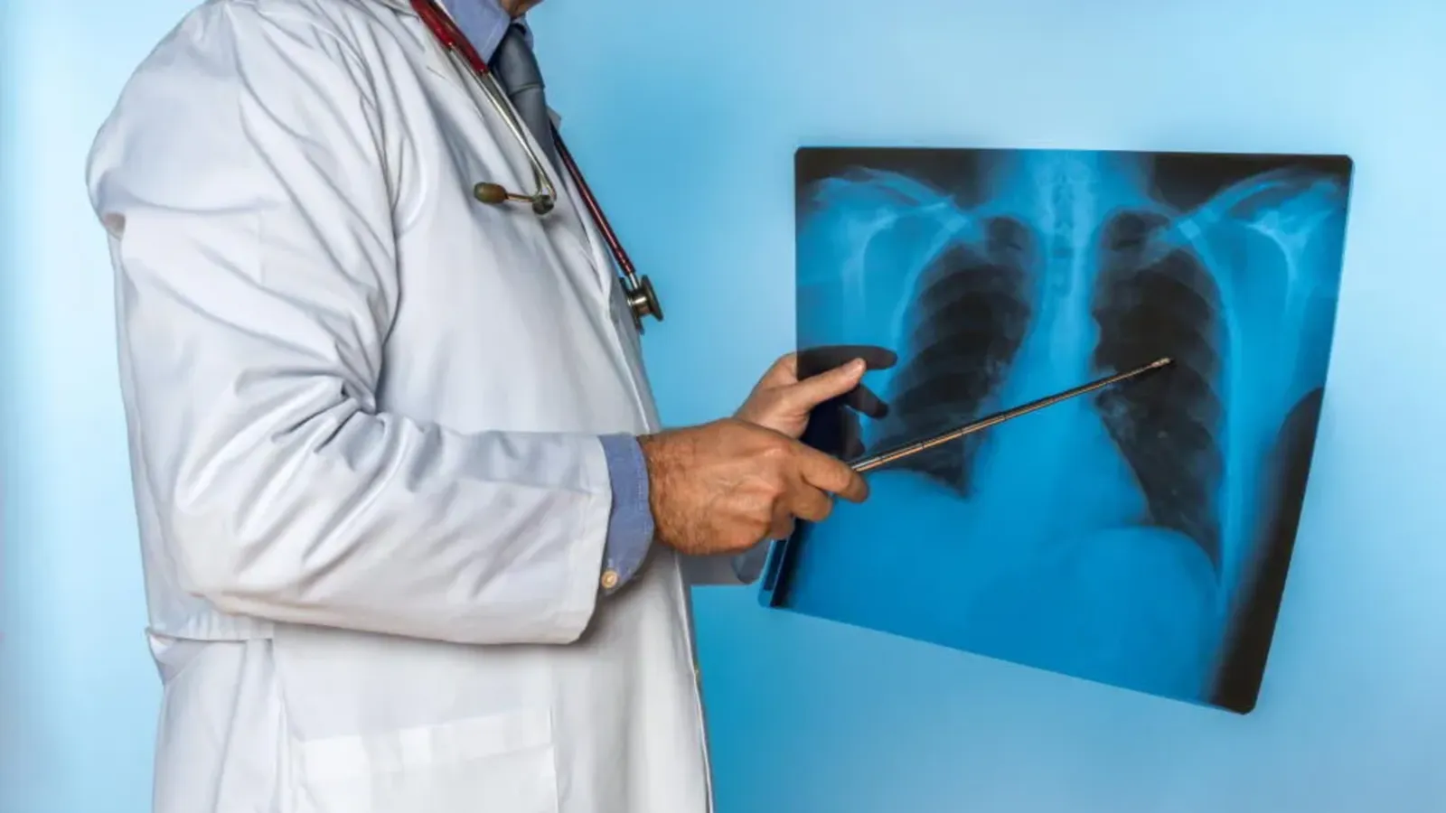 Kış aylarında KOAH başvuruları arttı; "Evin kirli havası atakları tetikliyor"