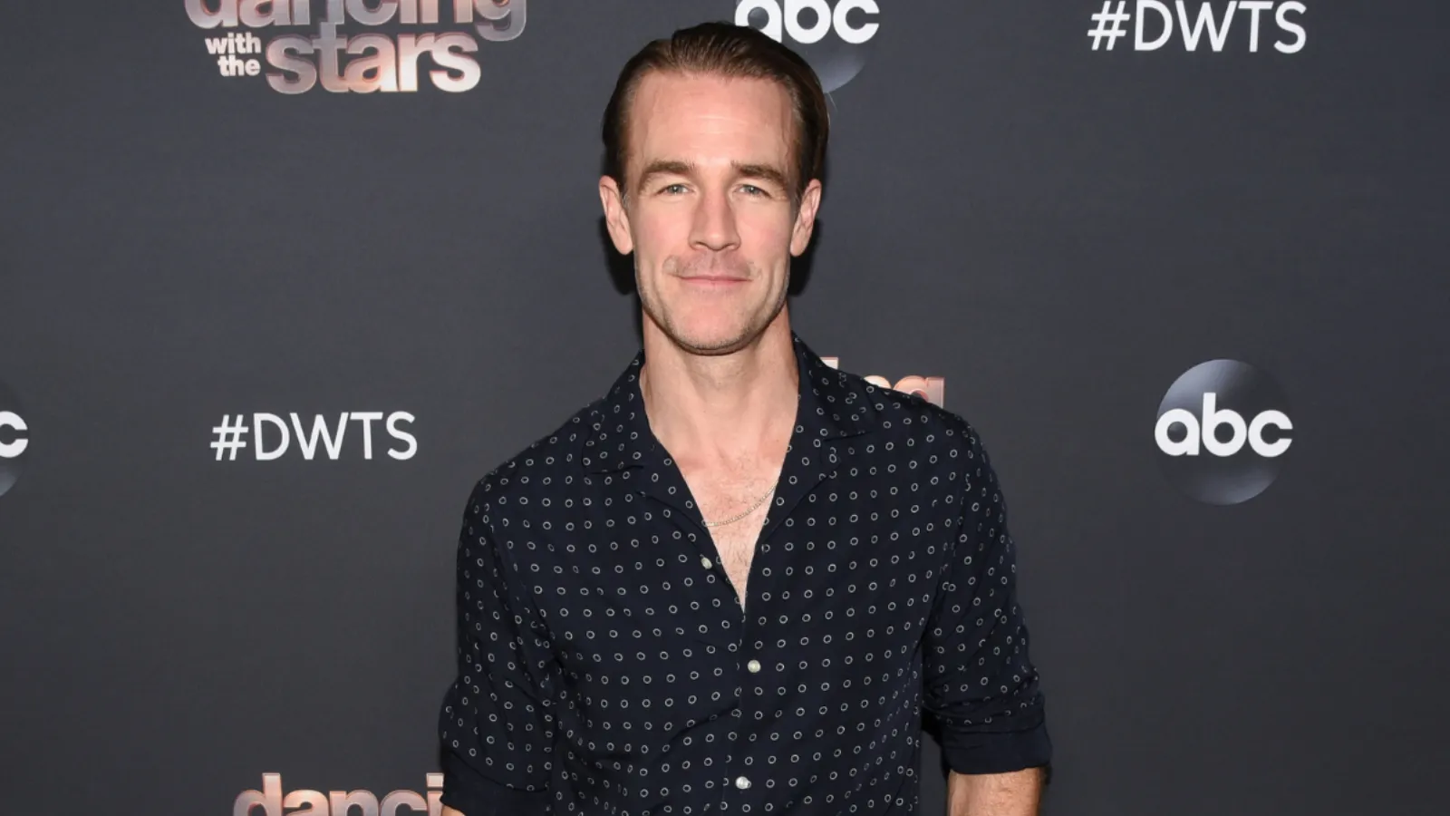 Dawson's Creek yıldızı James Van Der Beek, 48 yaşında hayatını kaybetti