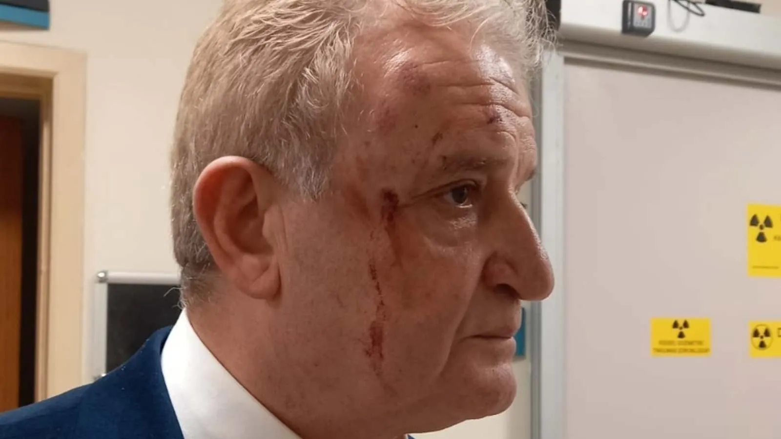 Eskişehir'de gazeteci Hakkı Sağlam'a yumruklu saldırı