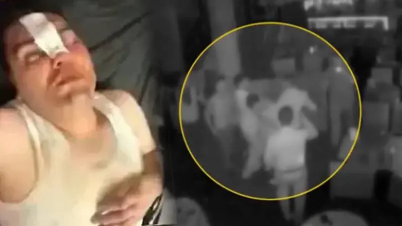 13 bin 500 liralık hesaba itiraz edince darbedildi: Çerezi arkadaşlarımla beraber, dayağı tek yedim!