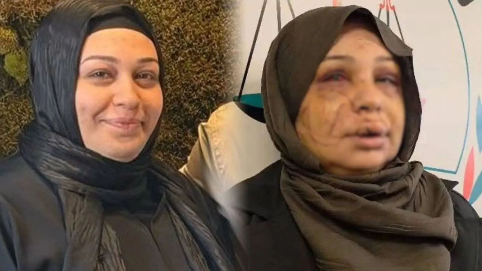 Eşini yaralayan polis memurunun dosyası, ağır cezaya gönderildi
