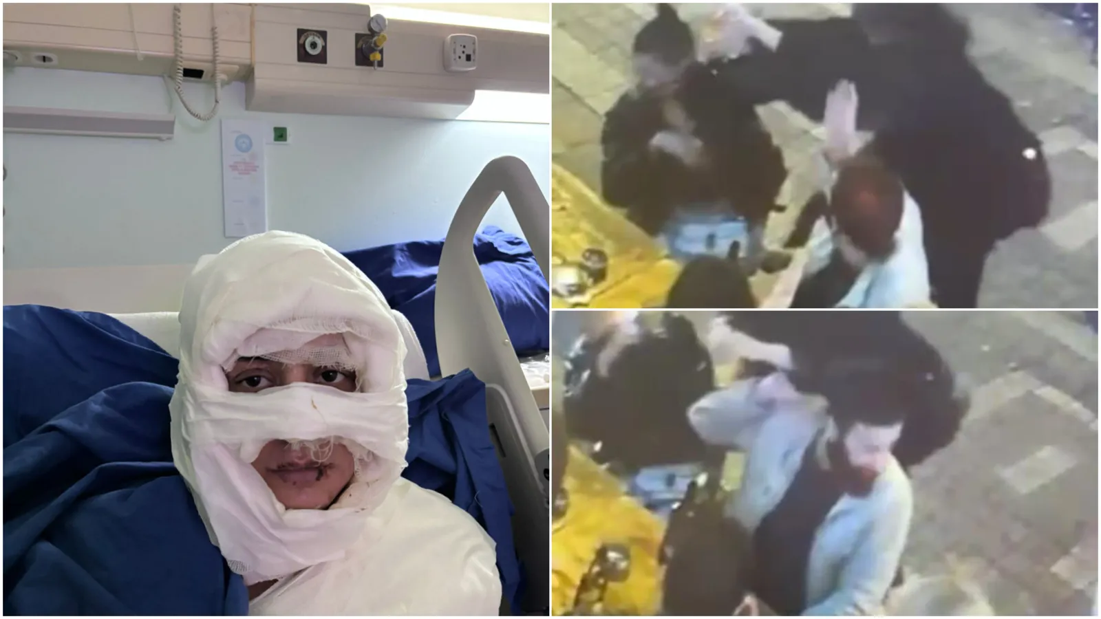 Kadıköy’de vahşet davası: Genç kadını kolonya döküp ateşe vermişti, hakim karşısına çıktı