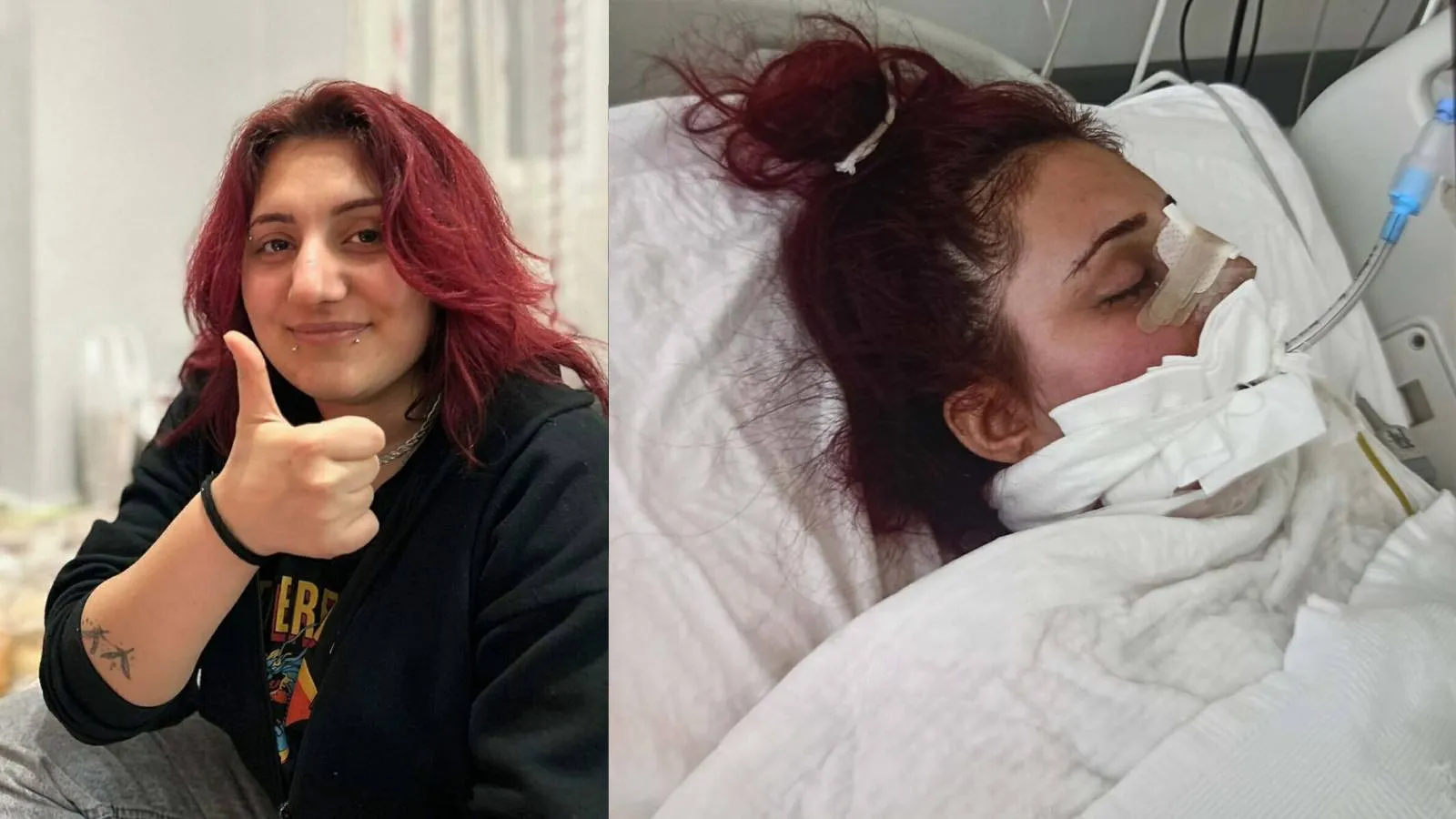 Burun estetiği ameliyatı sonrası hayatını kaybetti