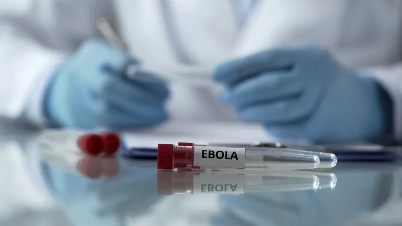 Uzmanından 'Ebola' uyarısı: Hasta kişilerle ve yabani hayvanlarla temastan kaçının!