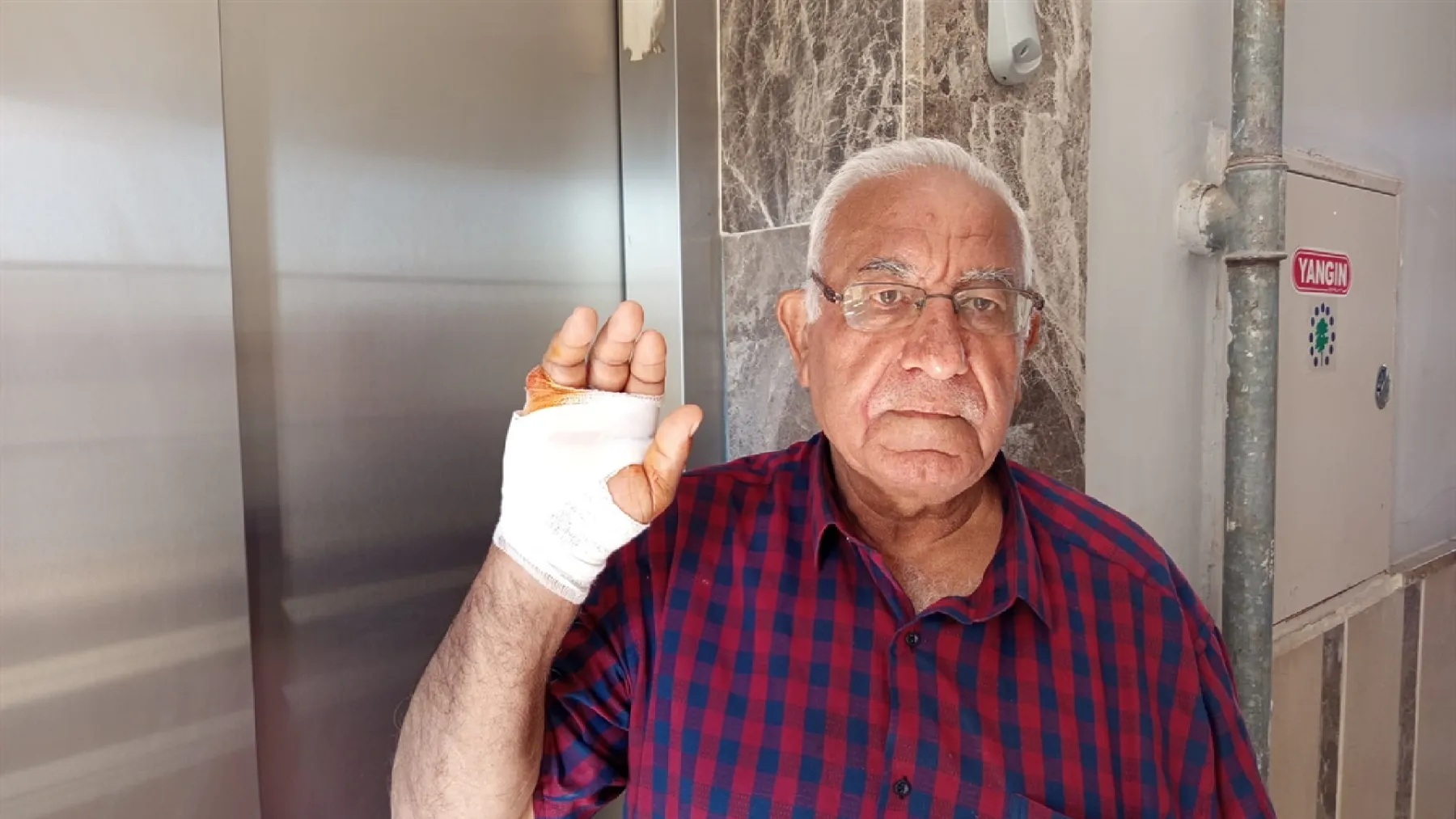 Komşular arasında asansör kavgası: Parmağını ısırdı, kopartana kadar bırakmadı!