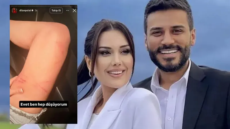 Darp izlerini paylaşıp silen Dilan Polat'tan Engin Polat'a: Boşanacaksın oğlum benden!