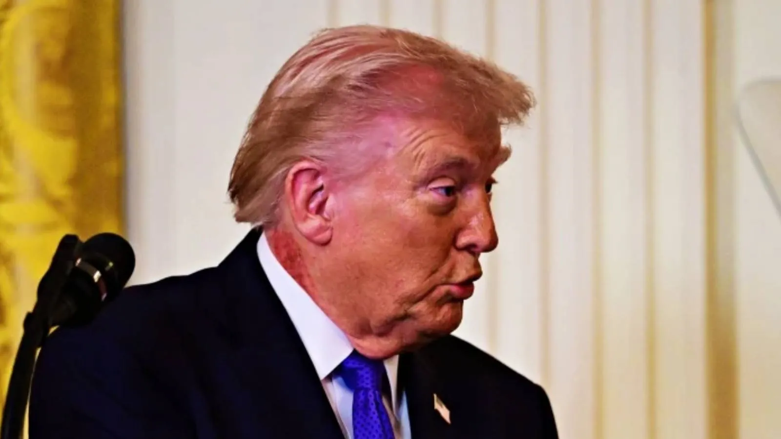 Ayak bileklerinde ve boynunda morluk vardı: Trump'tan sağlık durumuna ilişkin açıklama