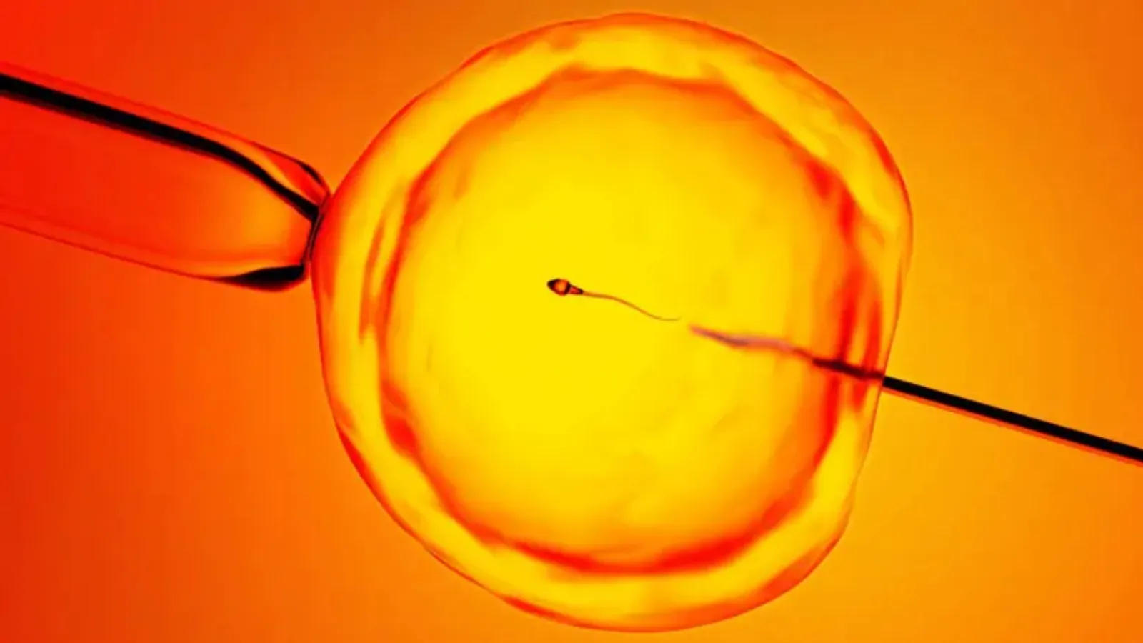 Kısırlık tedavisinde yeni umut: Yeni teknoloji yapay zekayla sperm buluyor