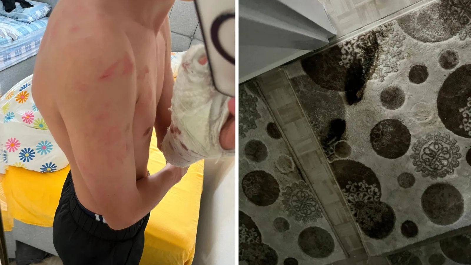 İddia: Polisler ‘yanlış adrese’ baskın yaptı; aile darbedildi, 15 yaşındaki çocuğun kolu kırıldı!