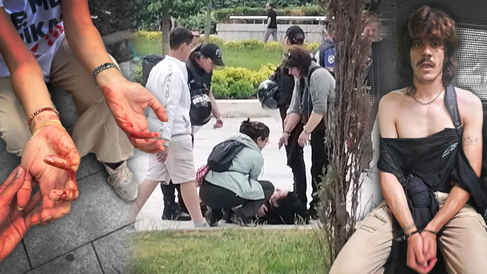 Öğretmenlere polis müdahalesi: Sendika yaralanan eğitimcilerin görüntülerini paylaştı