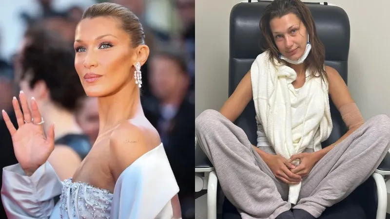Bella Hadid paylaşımıyla hayranlarını endişelendirdi: Tedaviler işe yaramıyor!