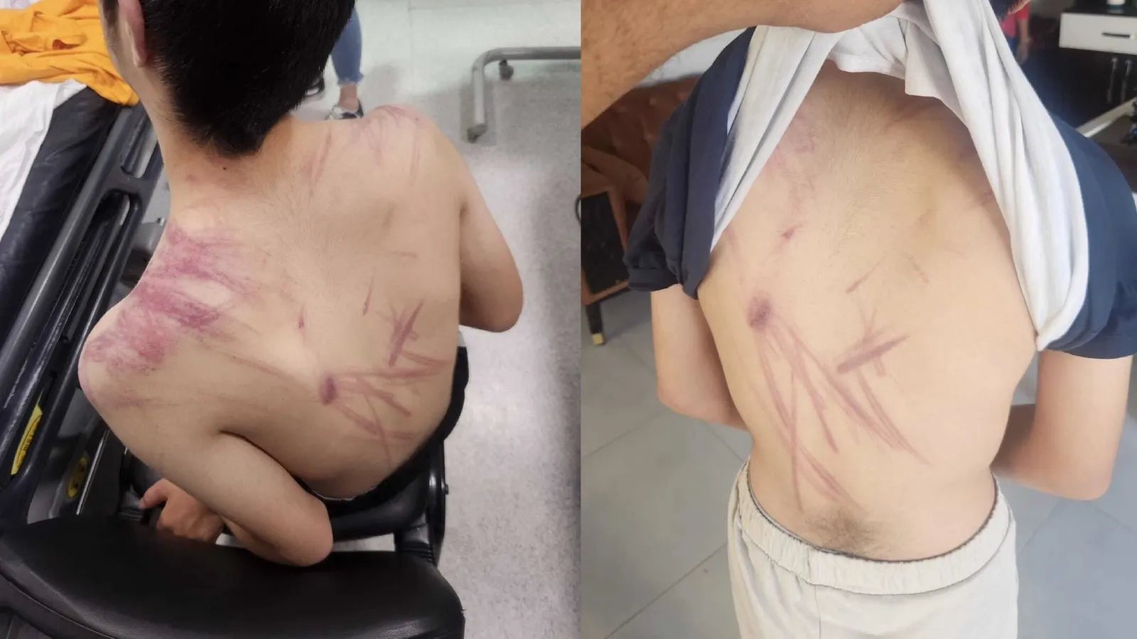Elazığ’da rehabilitasyon merkezinde down sendromlu çocuğa şiddet iddiası