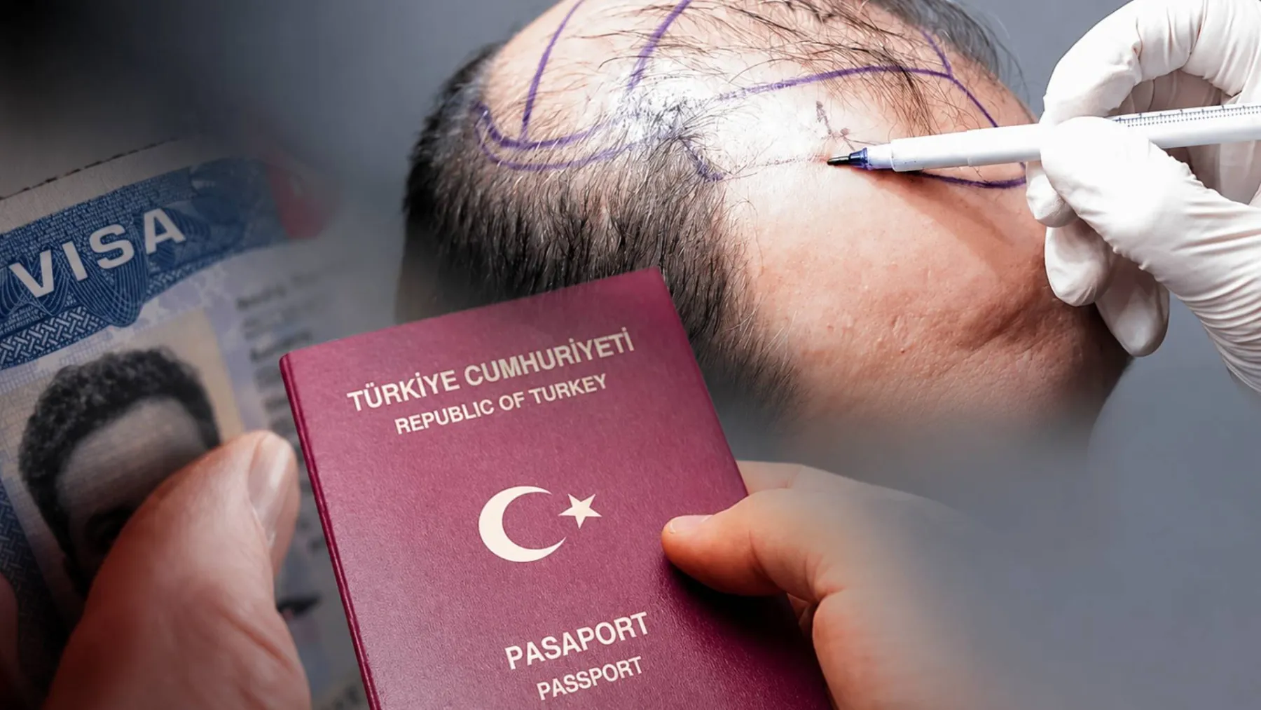 Vize garantisinden saç çıkarma vaadine; hayal satan reklamlar Ticaret Bakanlığı'na takıldı!