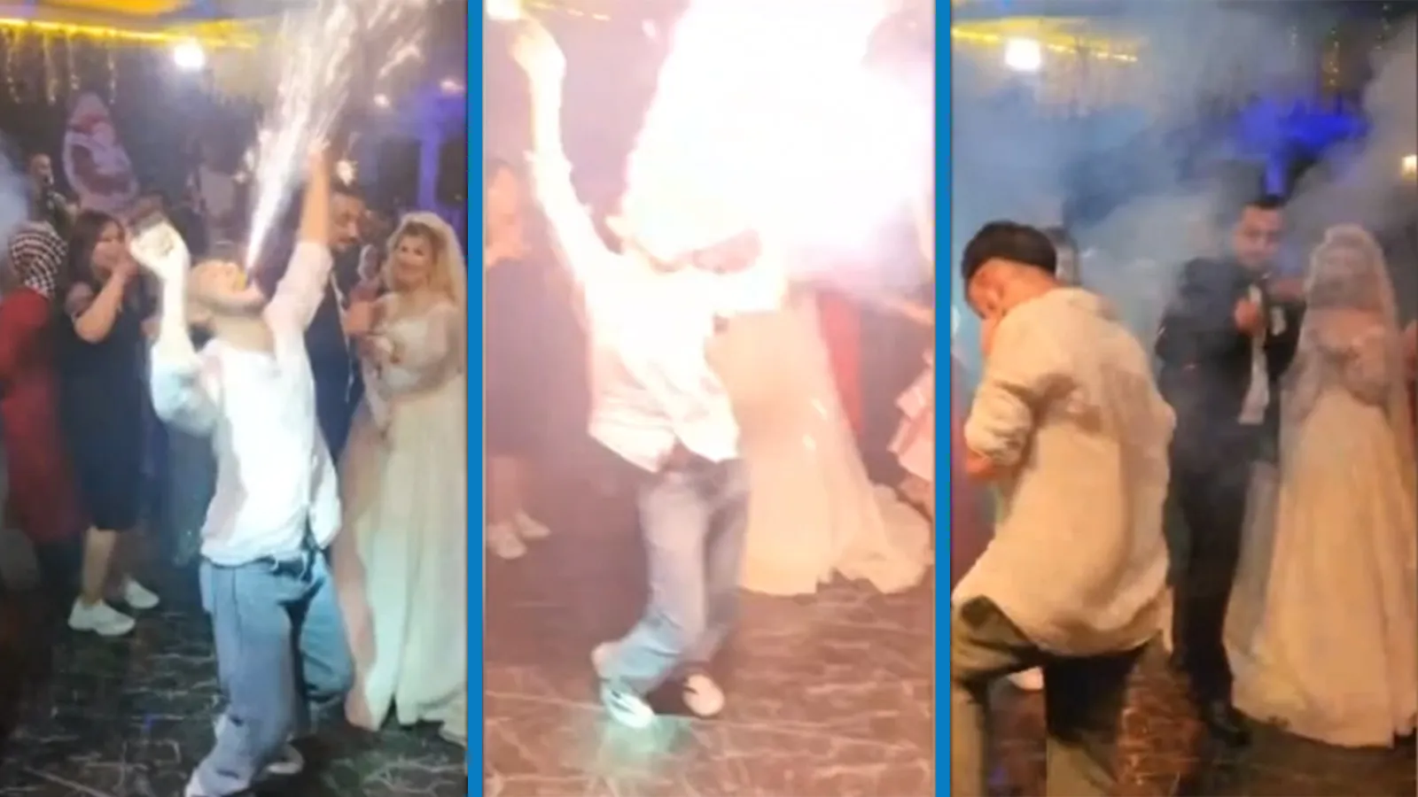 Meşale yüzüne patladı!
