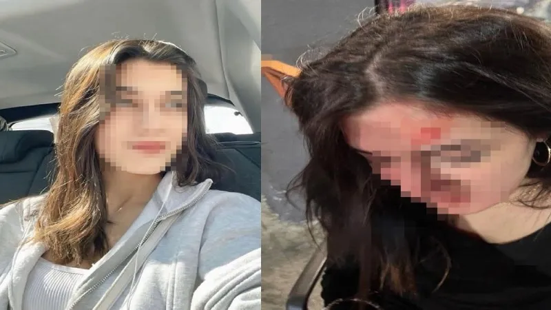 22 yaşındaki Belinay’ı sokak ortasında darp etmişlerdi: 2 sanığa haksız tahrik indirimiyle 1 yıl 1 ay hapis